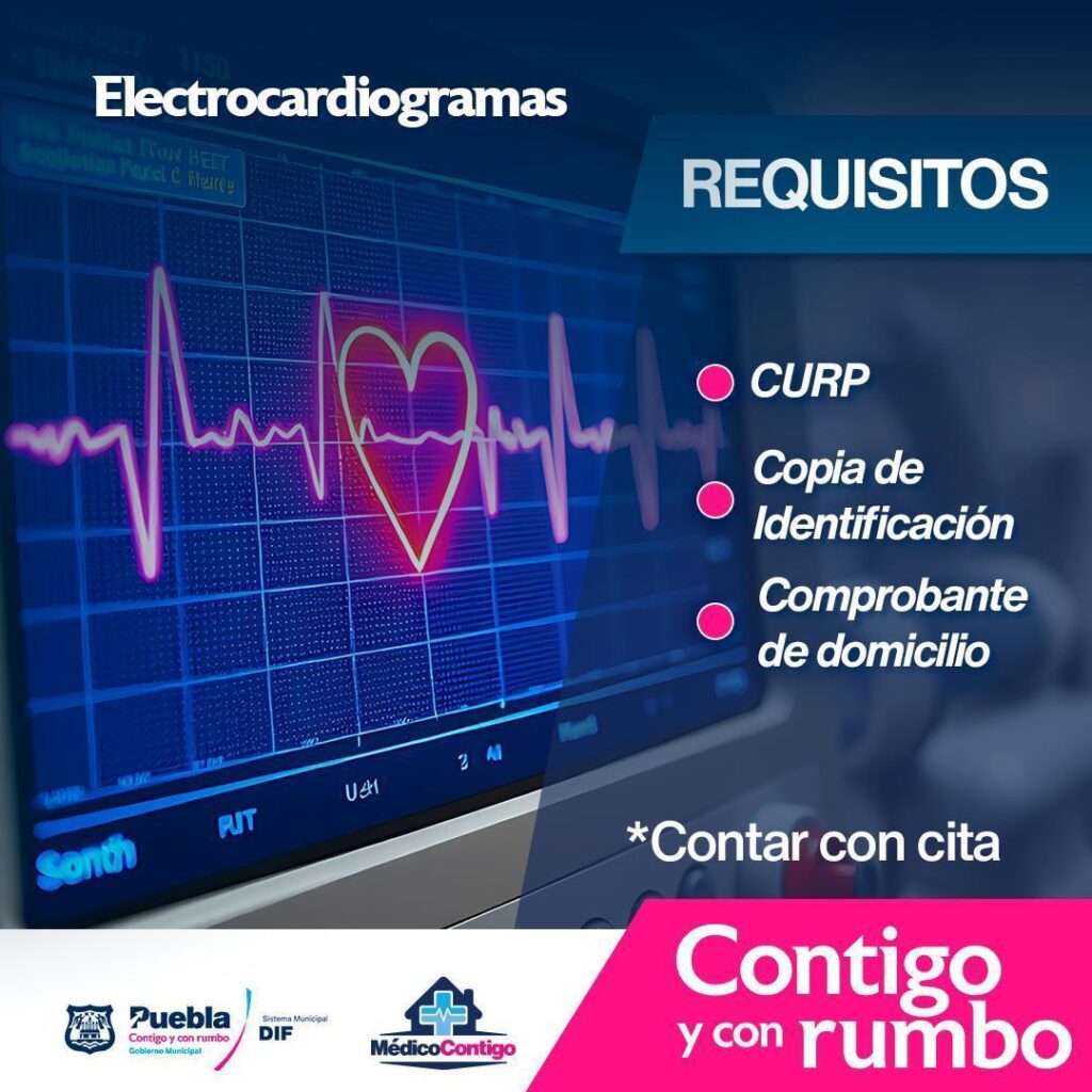 Electrocardiogramas